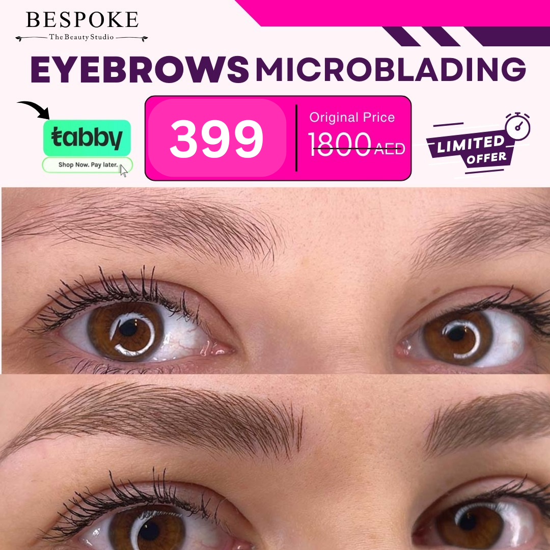 399